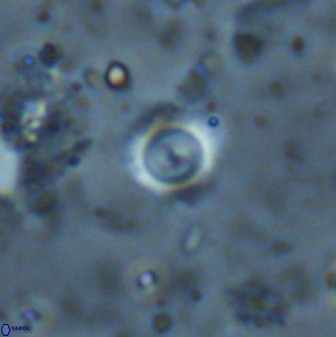 Cyclagelosphaera rotaclypeata 38080
