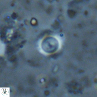 Cyclagelosphaera rotaclypeata 38080