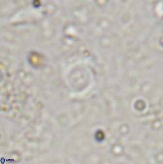 Cyclagelosphaera rotaclypeata 38082