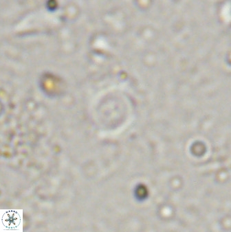 Cyclagelosphaera rotaclypeata 38082
