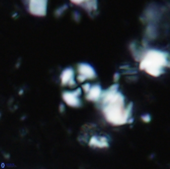 Cyclagelosphaera shenleyensis 1292