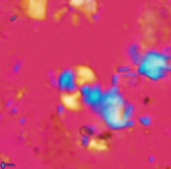 Cyclagelosphaera shenleyensis 1293