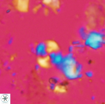 Cyclagelosphaera shenleyensis 1293