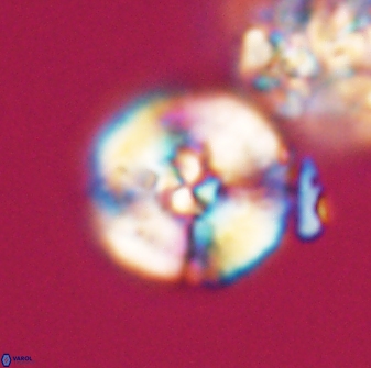 Cyclagelosphaera sp A 22915