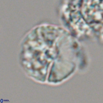 Cyclagelosphaera sp A 22916
