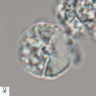 Cyclagelosphaera sp A 22916