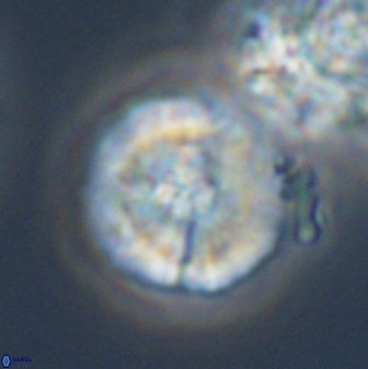 Cyclagelosphaera sp A 22917