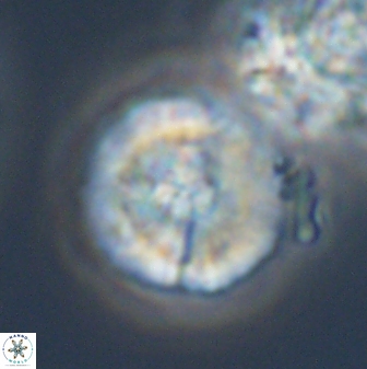 Cyclagelosphaera sp A 22917