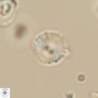 Cyclagelosphaera sp A 67073