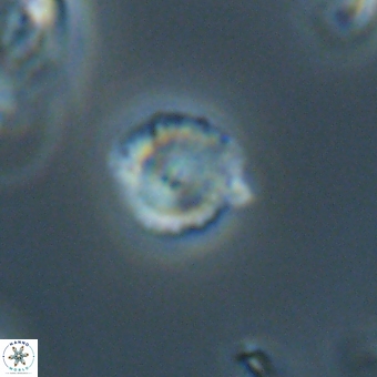 Cyclagelosphaera sp A 67075