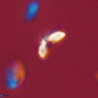 Cyclagelosphaera sp A 67084