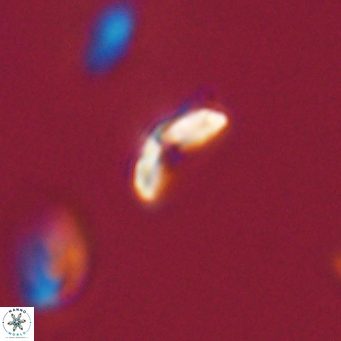 Cyclagelosphaera sp A 67084