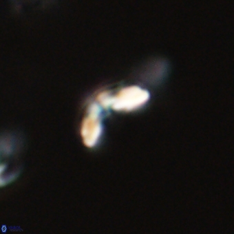 Cyclagelosphaera sp A 67099