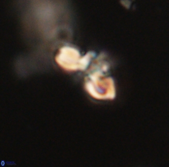 Cyclagelosphaera sp B 63672