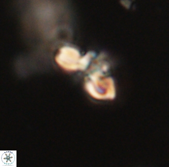 Cyclagelosphaera sp B 63672