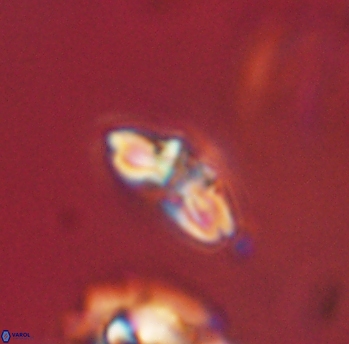Cyclagelosphaera sp B 63674