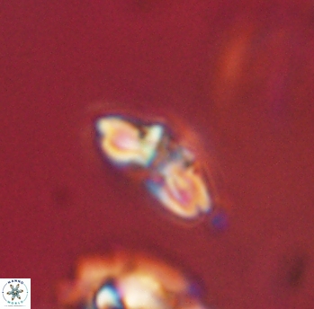 Cyclagelosphaera sp B 63674