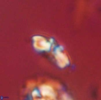 Cyclagelosphaera sp B 63675