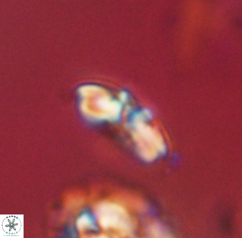 Cyclagelosphaera sp B 63675