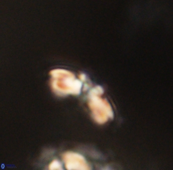 Cyclagelosphaera sp B 63676