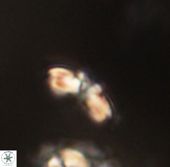 Cyclagelosphaera sp B 63676