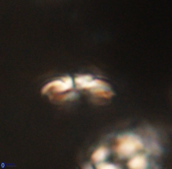 Cyclagelosphaera sp B 63677