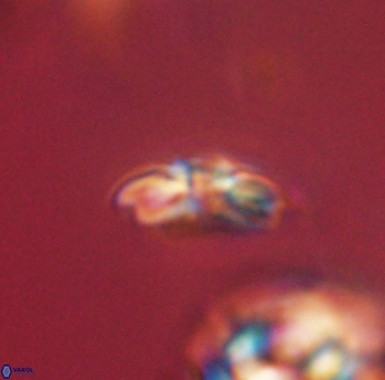 Cyclagelosphaera sp B 63678