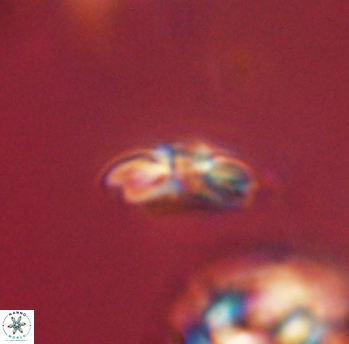 Cyclagelosphaera sp B 63678