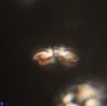 Cyclagelosphaera sp B 63679