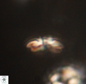Cyclagelosphaera sp B 63679