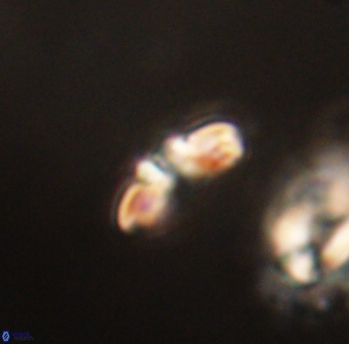 Cyclagelosphaera sp B 63680