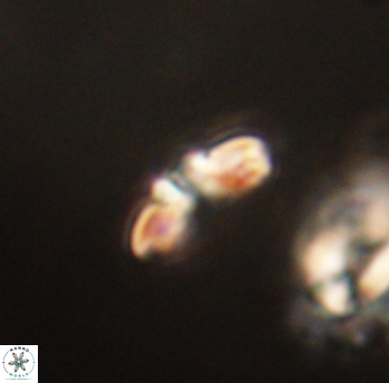 Cyclagelosphaera sp B 63680