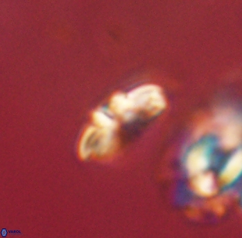 Cyclagelosphaera sp B 63681