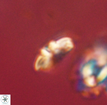 Cyclagelosphaera sp B 63681