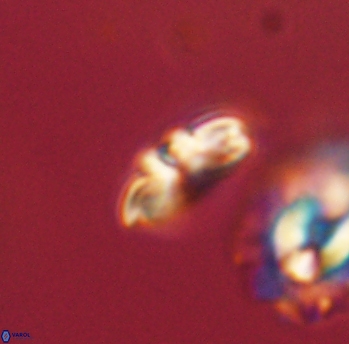 Cyclagelosphaera sp B 63682