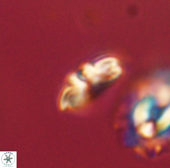 Cyclagelosphaera sp B 63682