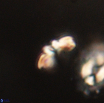 Cyclagelosphaera sp B 63683