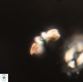 Cyclagelosphaera sp B 63683