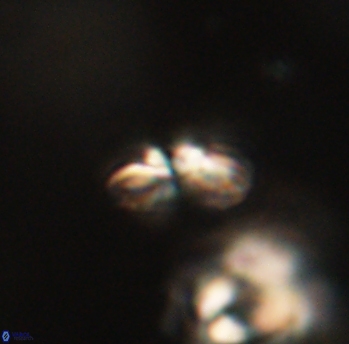 Cyclagelosphaera sp B 63684