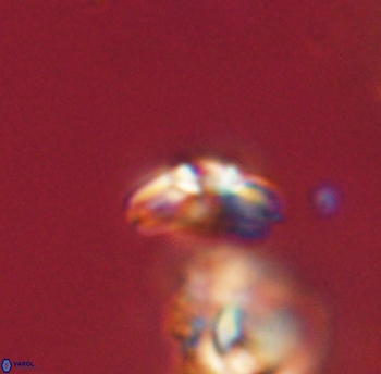Cyclagelosphaera sp B 63686
