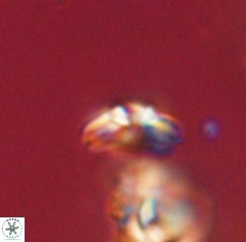 Cyclagelosphaera sp B 63686