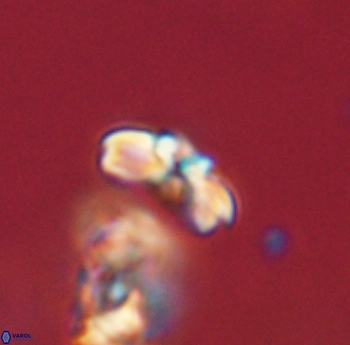 Cyclagelosphaera sp B 63687