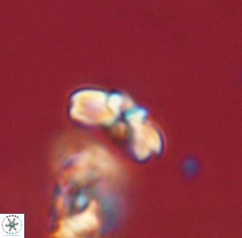 Cyclagelosphaera sp B 63687