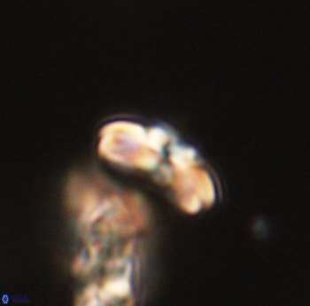 Cyclagelosphaera sp B 63689