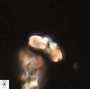 Cyclagelosphaera sp B 63689