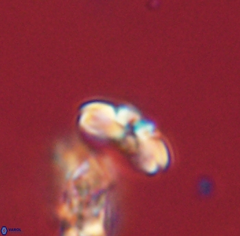 Cyclagelosphaera sp B 63690
