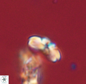 Cyclagelosphaera sp B 63690