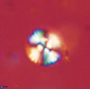 Cyclagelosphaera sp B 63691