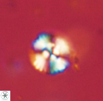 Cyclagelosphaera sp B 63691