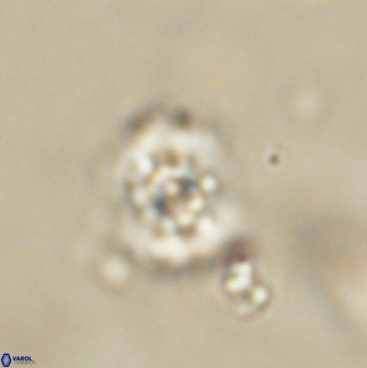 Cyclagelosphaera sp B 63701